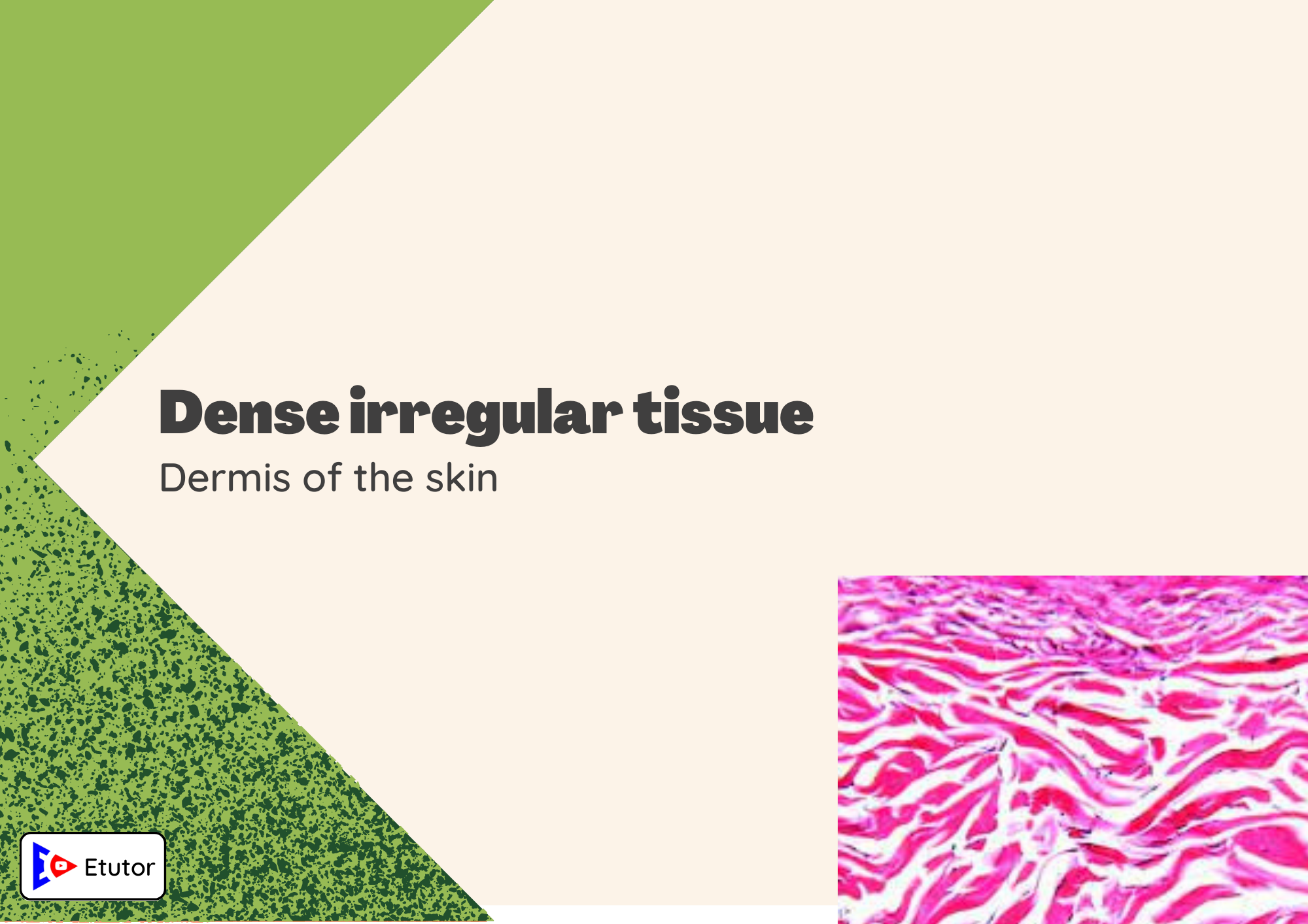 dense irregular tissues